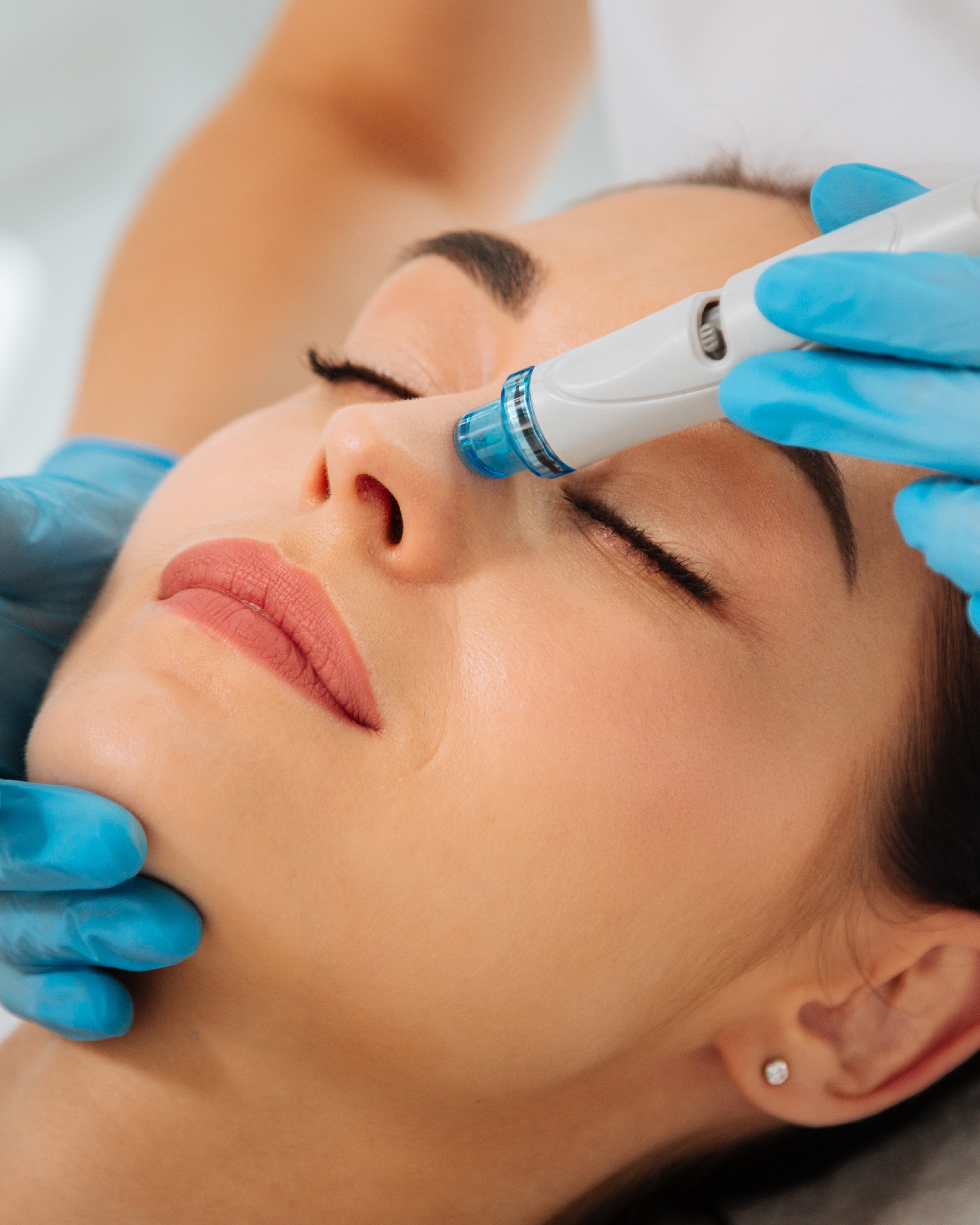HydraFacial Premium Skin Cleansing and Hydro Infusion