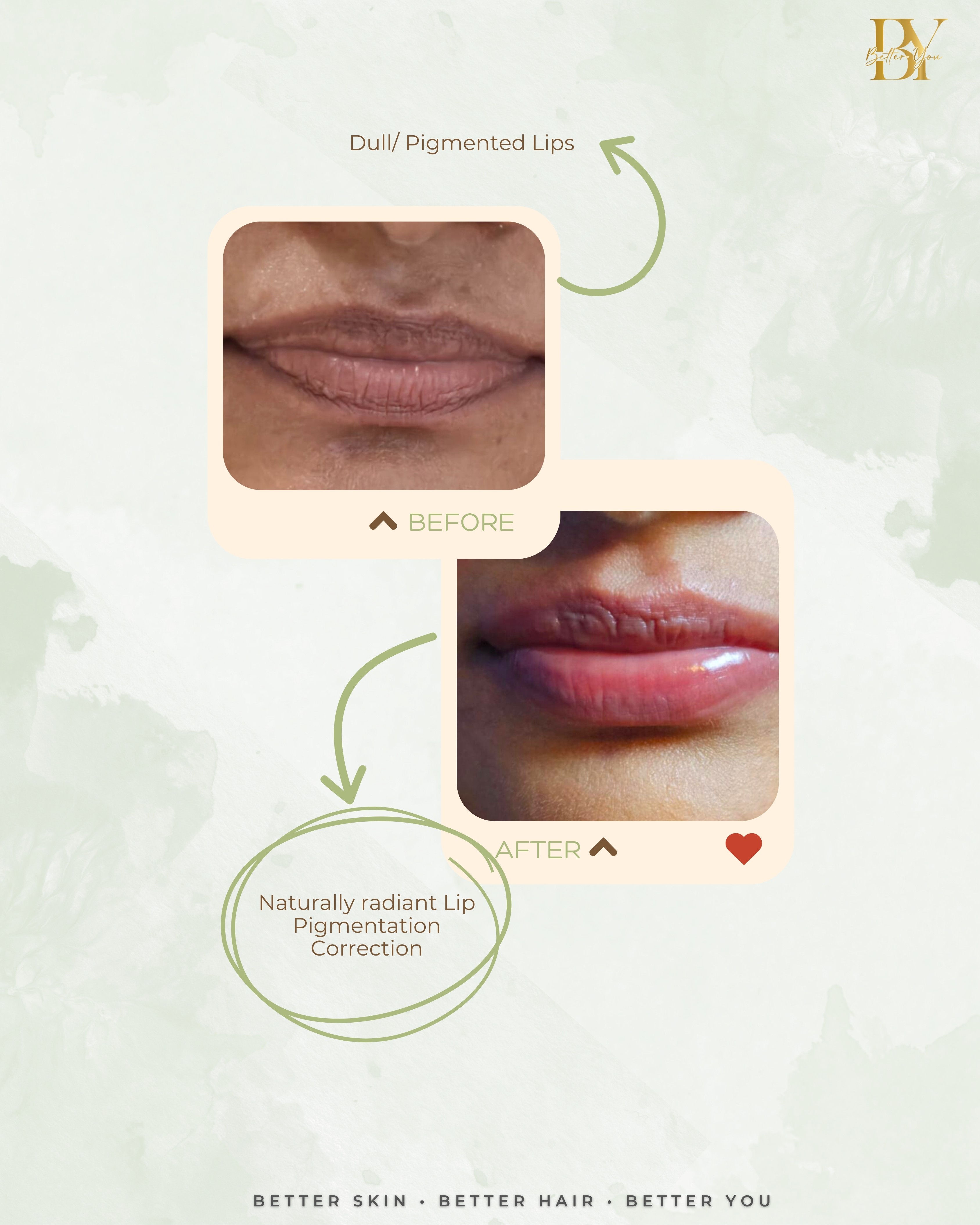 Advanced Melanin Skin Lightening Therapy Updates